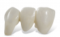 Preview: Cad/Cam offene Systeme Disc 71er ( Ceramill AG) High Translucent/HT