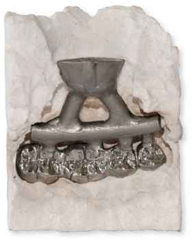 Ecovest PMS Spezial-Einbettmasse für CoCr-Legierungen 20x450g.