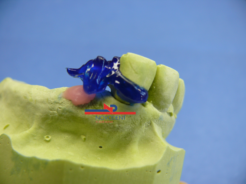 Novoplast Flash Set  1x3g+2xapplication Jet  in Farben ROT-BLAU-CLEAR