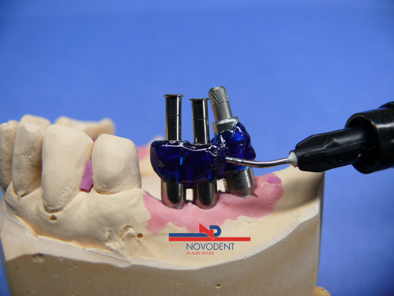 Novoplast Flash Set  1x3g+2xapplication Jet  in Farben ROT-BLAU-CLEAR