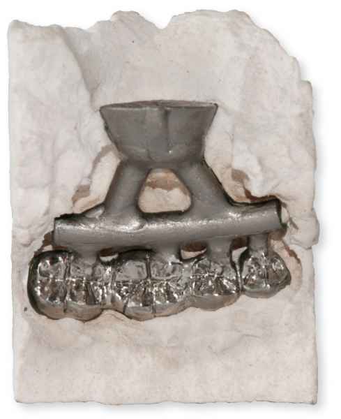 Ecovest PMS Spezial-Einbettmasse für CoCr-Legierungen 20x450g.